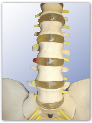 Dorn-Therapie – Physiotherapie Heck Viersen-Dülken
